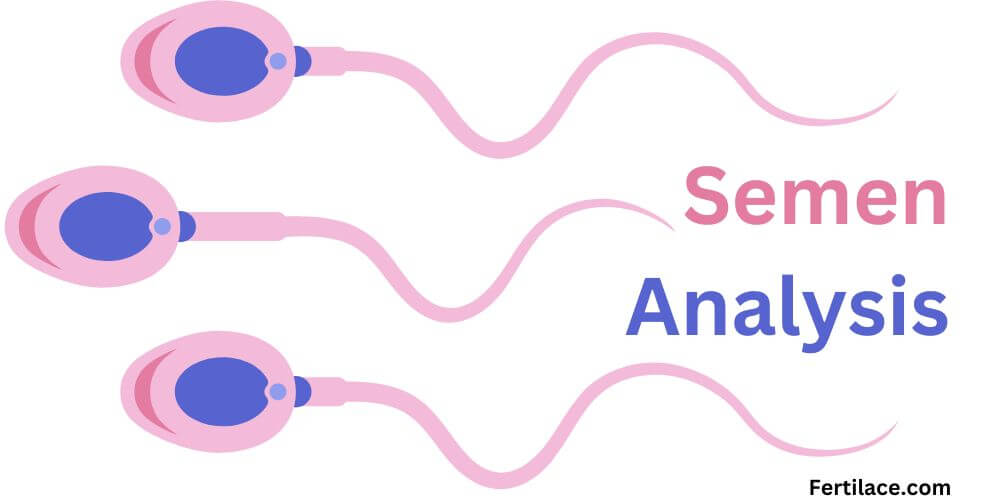 Semen analysis explained