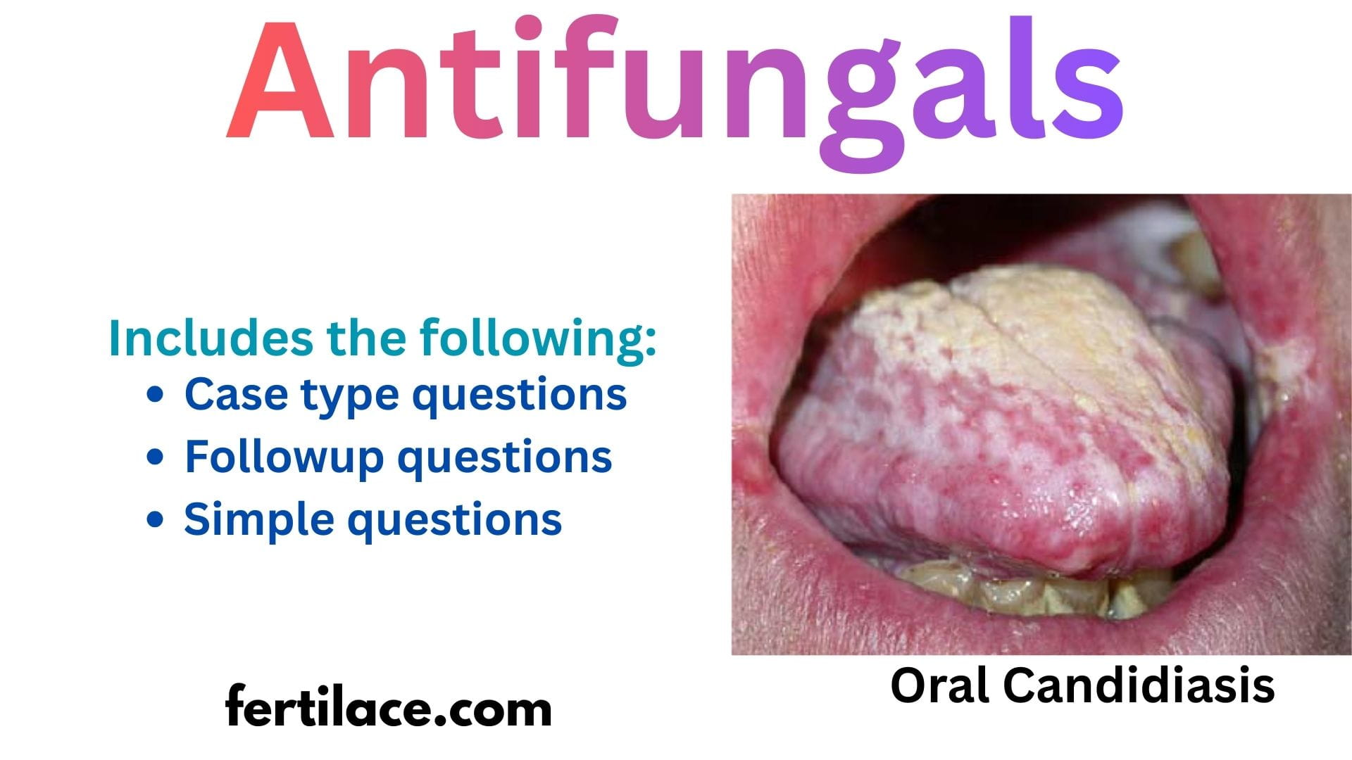 Antifungals practice Questions