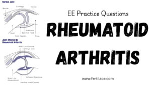 rheumatoid arthritis practice questions